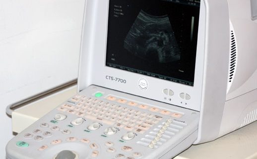 ultraschall gerät